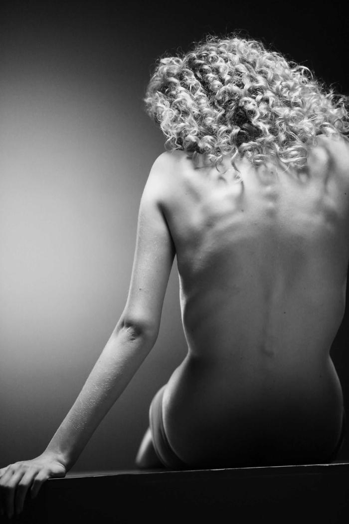ANOREXIA NERVOSA – EPÍLOGO: Casos famosos